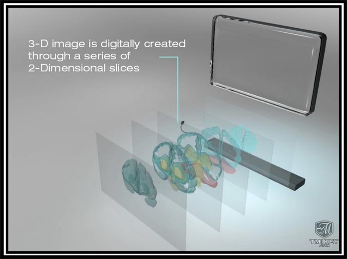 3DTV Expansion Diagram